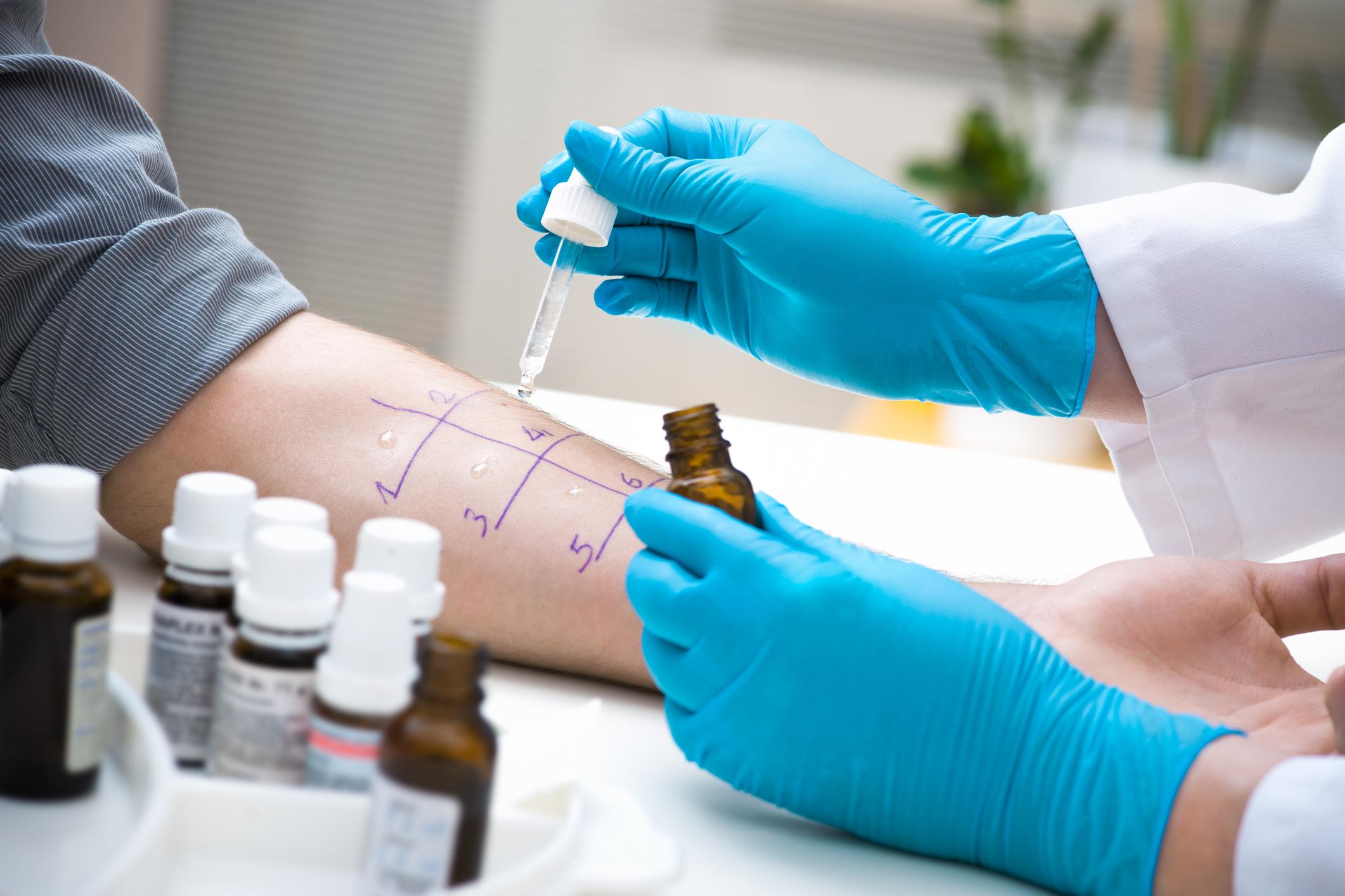 Unité d’immuno-allergologie 