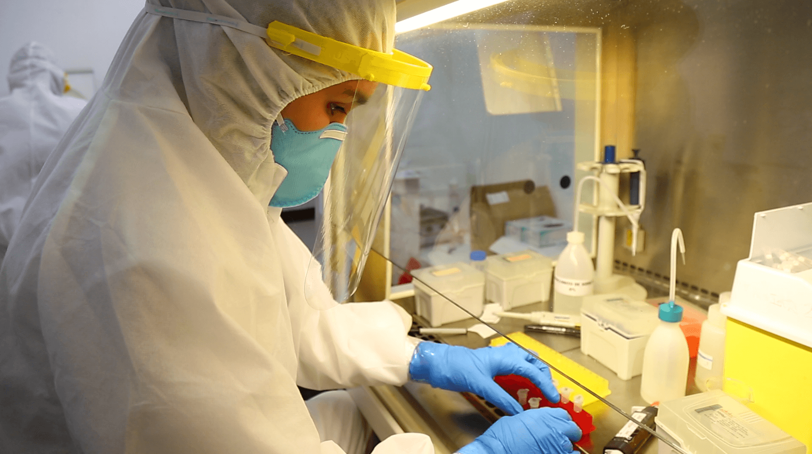 Unité d’immunogénétique et d'histocompatibilité 